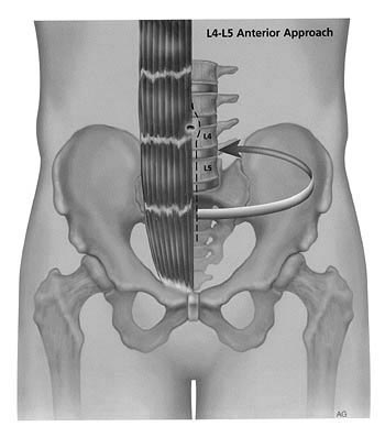 Surgical Approach