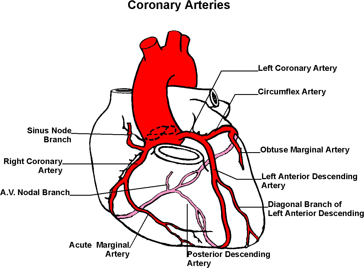 The problem with the arteries