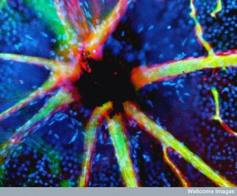 Blood Vessels Emerging from the Optic Nerve 